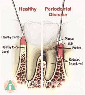  Nguyên tắc phục hình răng sứ
